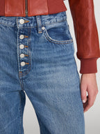 The Loose Exposed Buttons