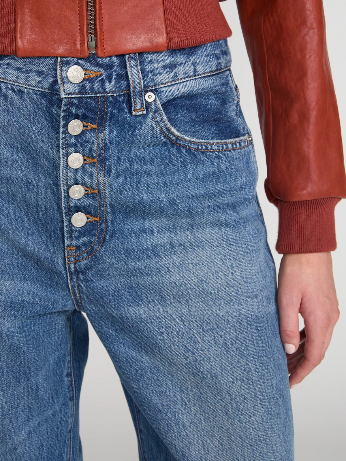 The Loose Exposed Buttons