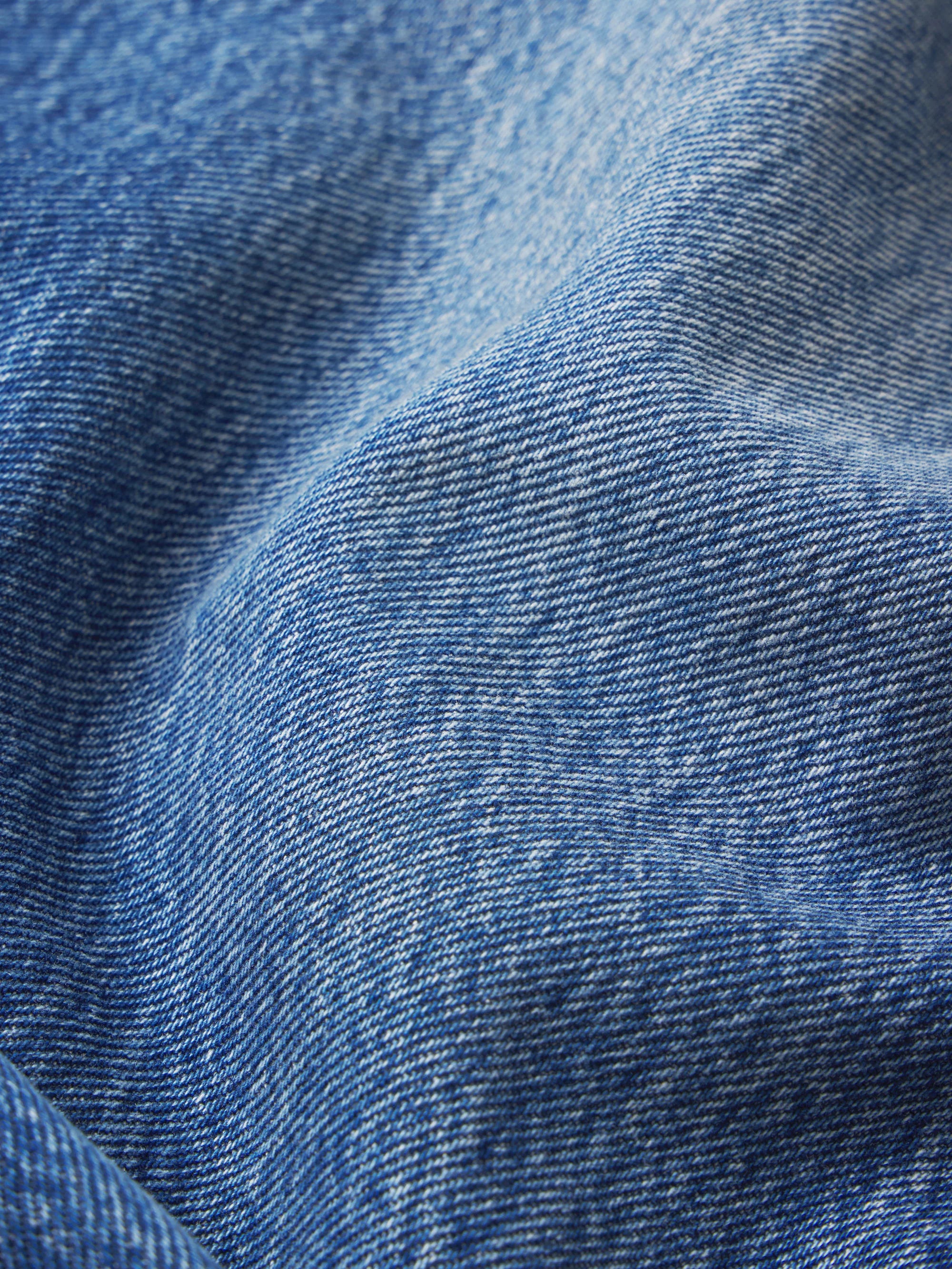 The Loose Exposed Buttons