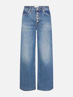 The Loose Exposed Buttons